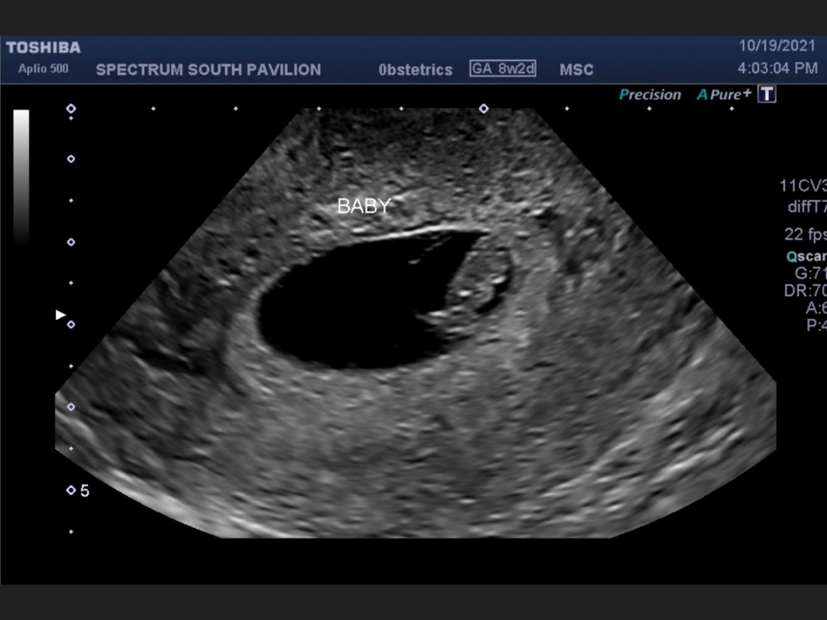 Picture of Expecting!!