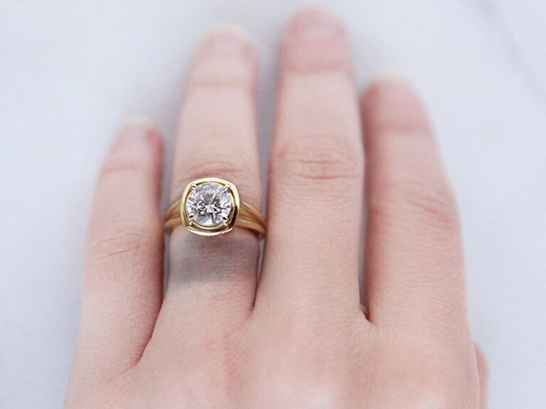Allergic reaction from engagement ring