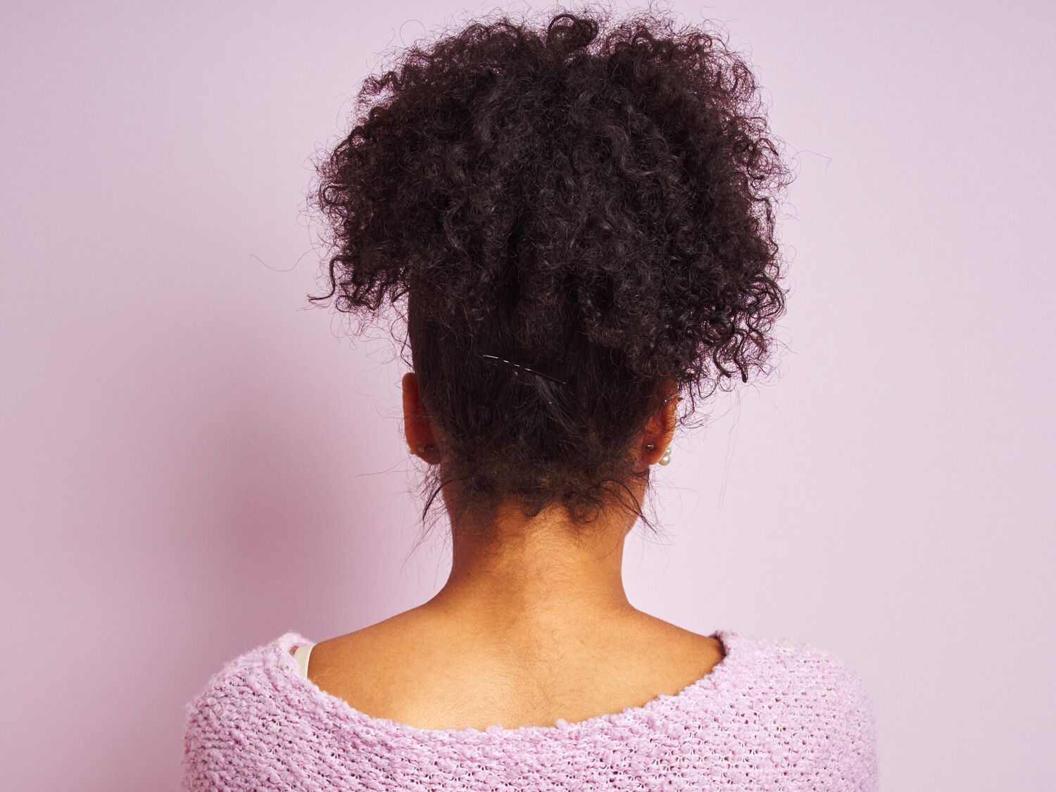 stress related hair loss