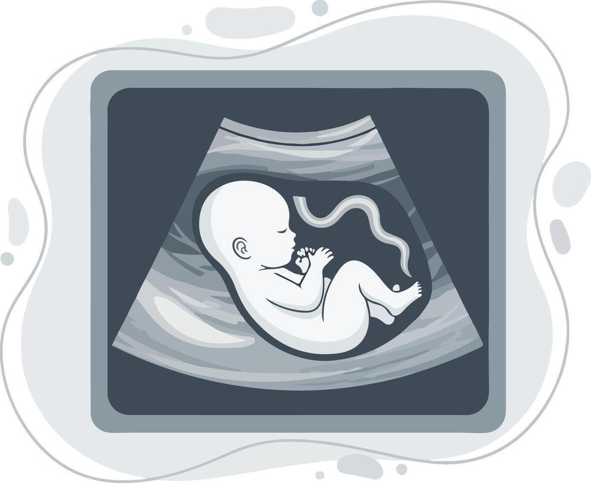 First ultrasound! Placeholder date
Size: 
Weight: