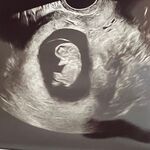 Baby Gutierrez